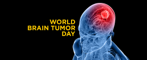 Brain Tumor - KDAH Blog - Health & Fitness Tips for Healthy Life