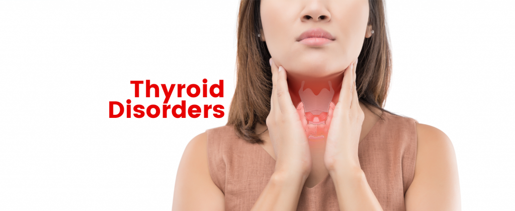 Thyroid Disorders - KDAH Blog - Health & Fitness Tips For Healthy Life