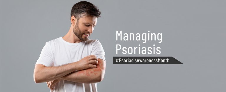 Managing Psoriasis - KDAH Blog - Health & Fitness Tips for Healthy Life